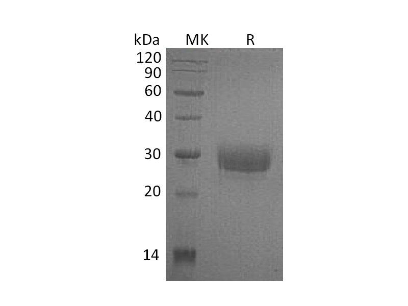 重组人CD32a (H167,C-6His)蛋白,Recombinant Human CD32a (H167,C-6His)