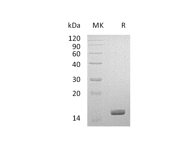 重组人LGALS14 (C-6His)蛋白,Recombinant Human LGALS14 (C-6His)