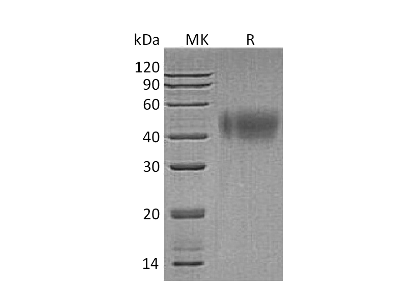 重组人IFNAR2 (C-6His)蛋白,Recombinant Human IFNAR2 (C-6His)