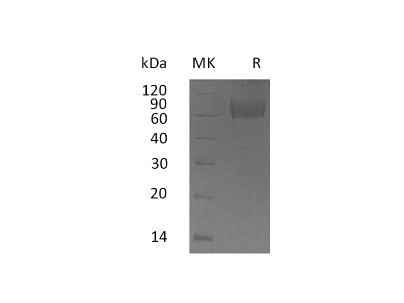 重组人IL-18BP (C-Fc)蛋白,Recombinant Human IL-18BP (C-Fc)