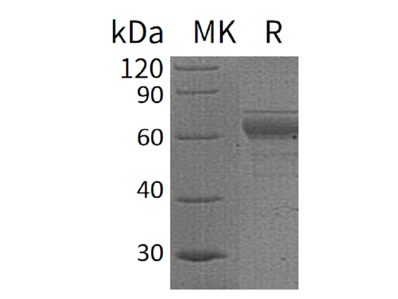 重组人IL-20RB (C-Fc)蛋白,Recombinant Human IL-20RB (C-Fc)