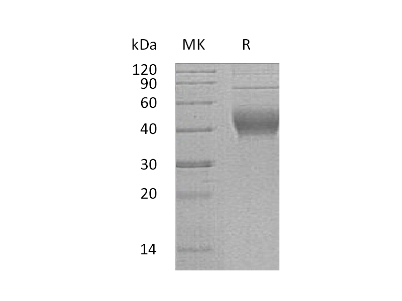 重组人IL-22RA2 (C-6His)蛋白,Recombinant Human IL-22RA2 (C-6His)