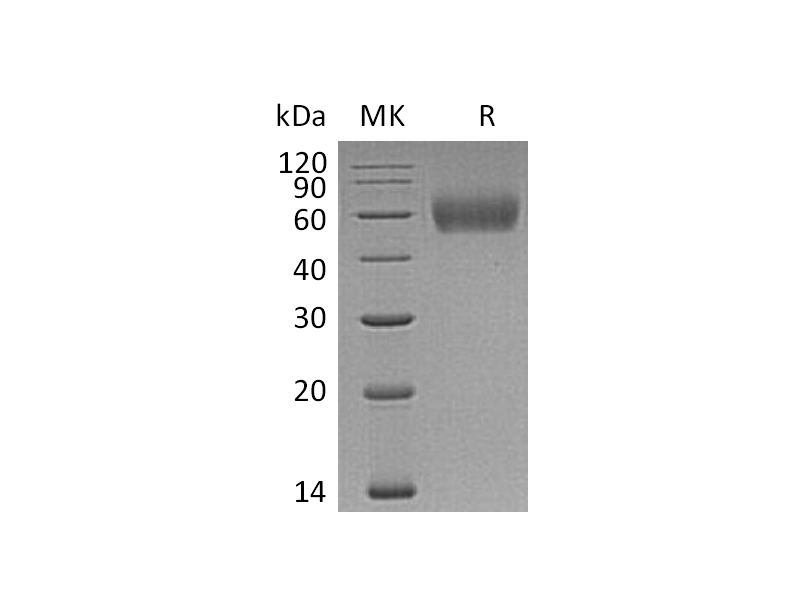 重组人IL-1R2 (C-6His)蛋白,Recombinant Human IL-1R2 (C-6His)