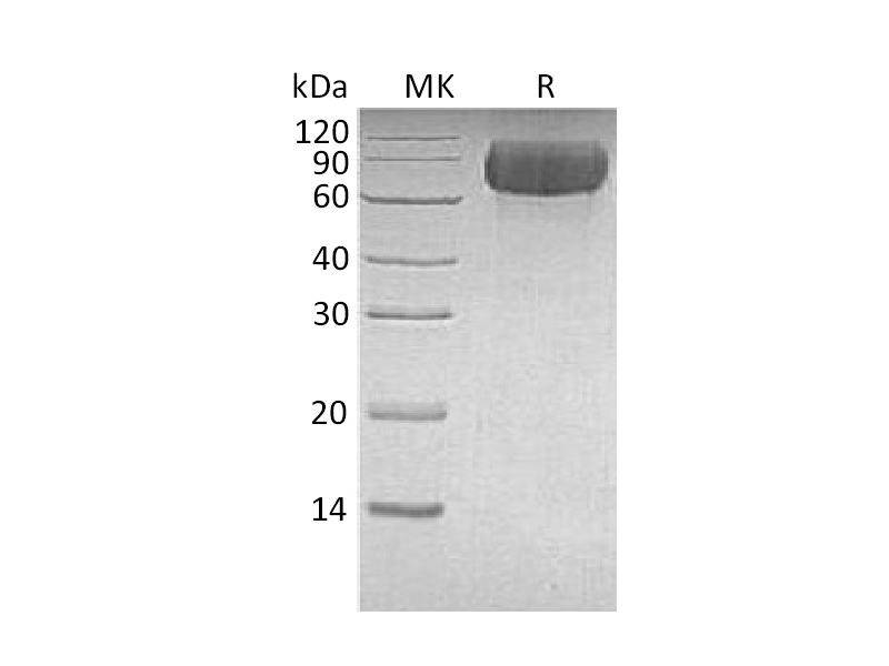 重组人LILRB1 (C-6His)蛋白,Recombinant Human LILRB1 (C-6His)