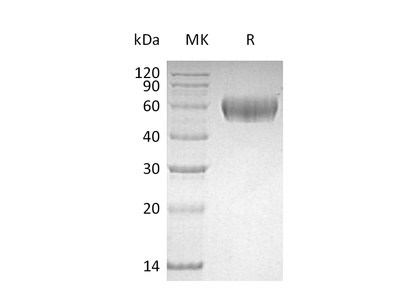 重组人Lumican (C-6His)蛋白,Recombinant Human Lumican (C-6His)