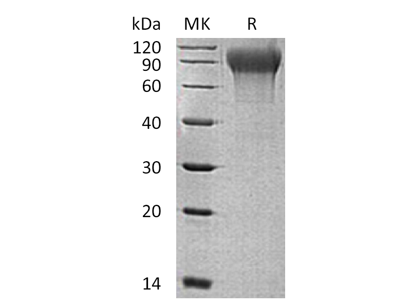 重组人MANSC1 (C-6His)蛋白,Recombinant Human MANSC1 (C-6His)