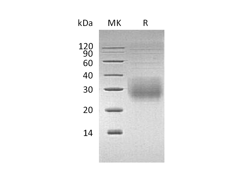 重组人NKG2A & CD94 Heterodimer (N-8His-Flag)蛋白,Recombinant Human NKG2A & CD94 Heterodimer (N-8His-Flag)