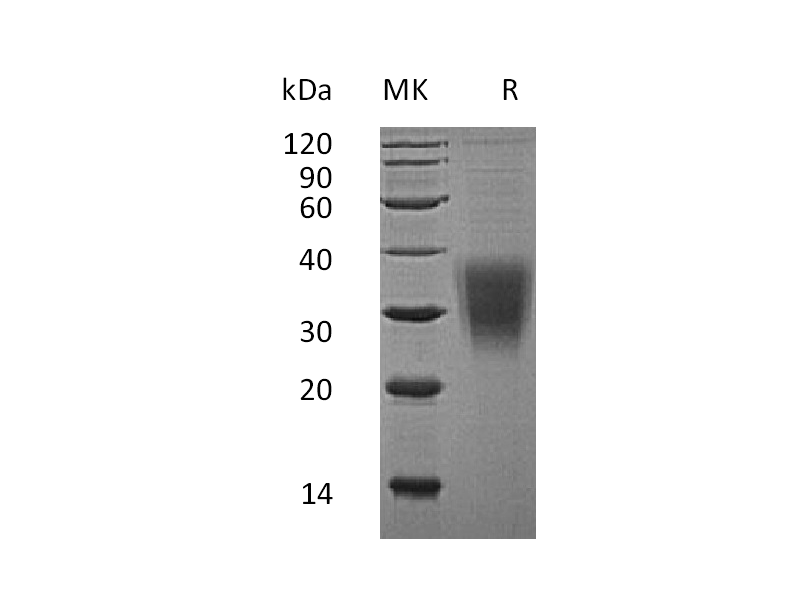 重组人NKG2A (N-8His)蛋白,Recombinant Human NKG2A (N-8His)