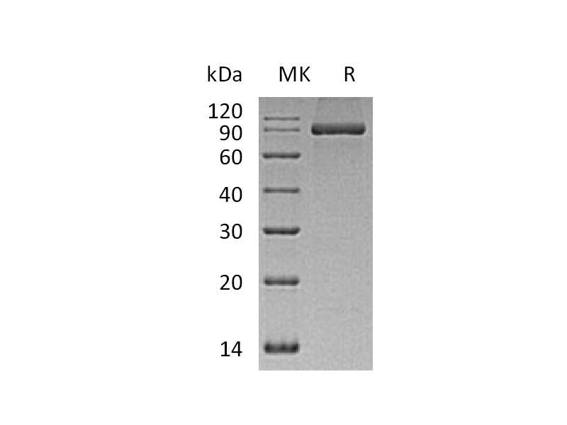 重组人PACSIN2 (C-6His)蛋白,Recombinant Human PACSIN2 (C-6His)