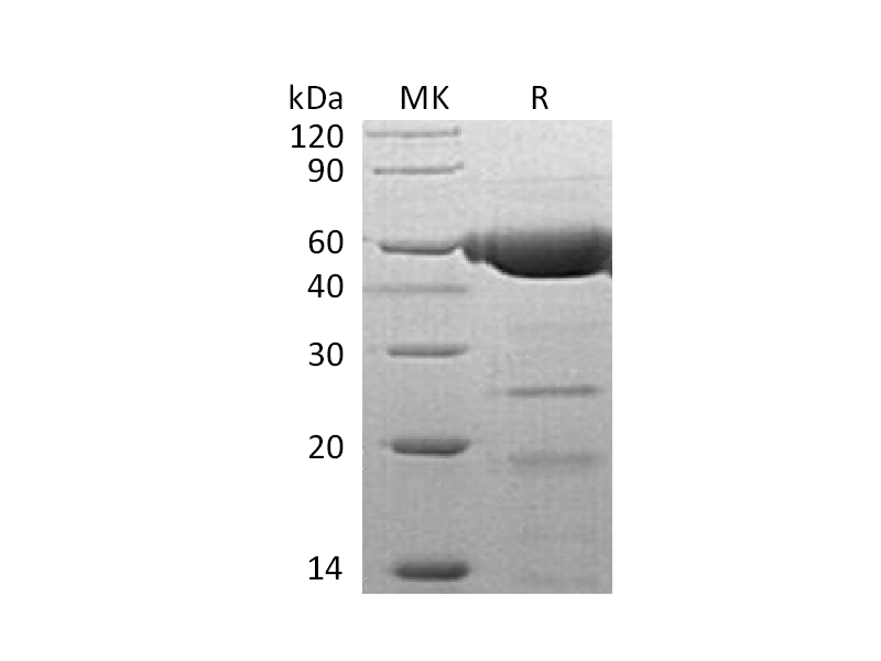 重组人PLRP2 (C-6His)蛋白,Recombinant Human PLRP2 (C-6His)