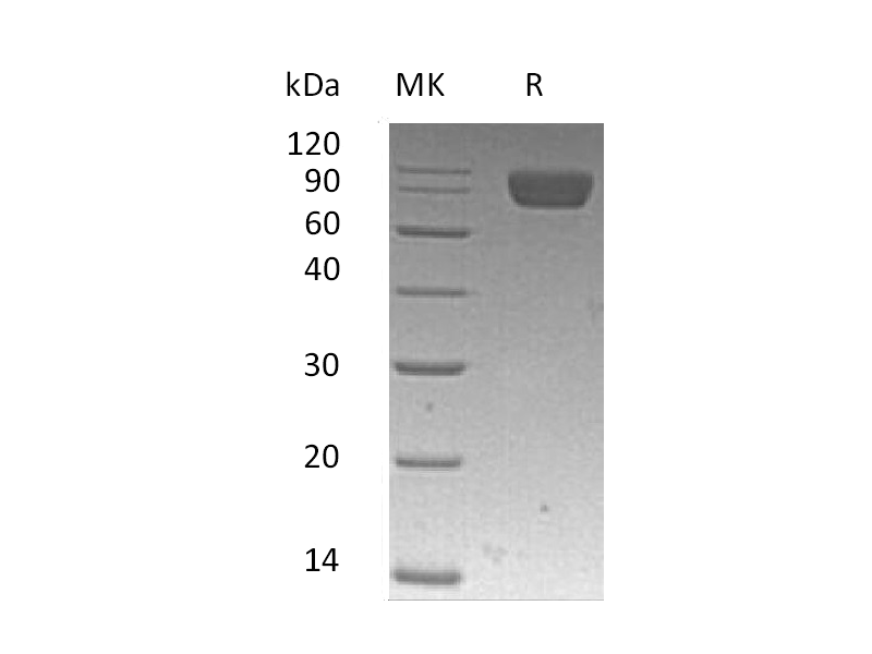 重组人PDGFRA (C-6His)蛋白,Recombinant Human PDGFRA (C-6His)