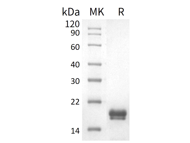 重组人REG1A (C-6His)蛋白,Recombinant Human REG1A (C-6His)