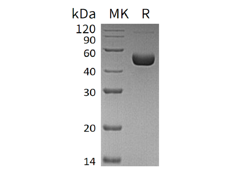 重组人Renin (C-10His)蛋白,Recombinant Human Renin (C-10His)