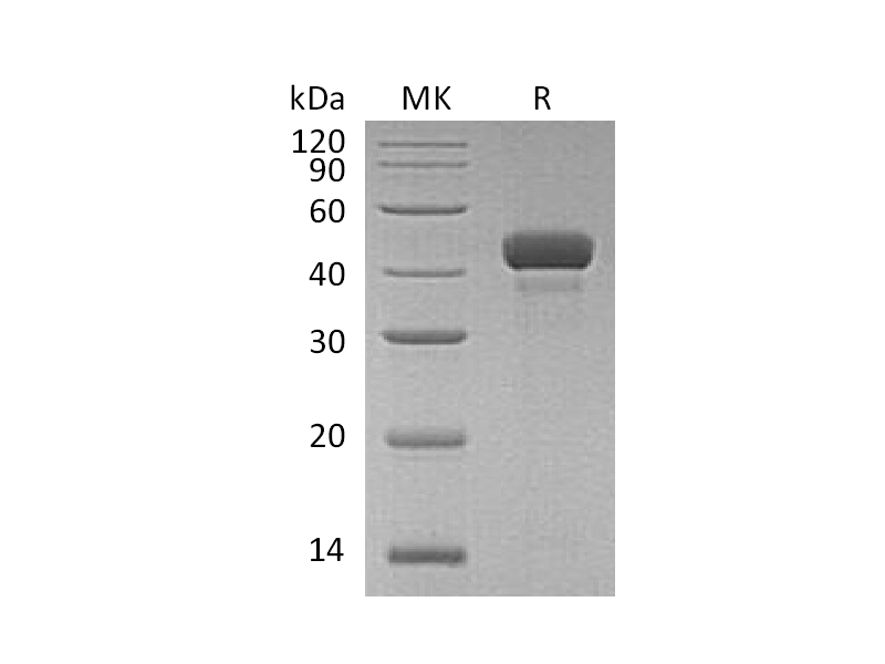 重组人RCN3 (C-6His)蛋白,Recombinant Human RCN3 (C-6His)