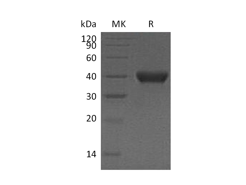 重组人RNASE T2 (C-6His)蛋白,Recombinant Human RNASE T2 (C-6His)
