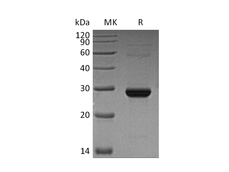 重组人TK1 (C-6His)蛋白,Recombinant Human TK1 (C-6His)