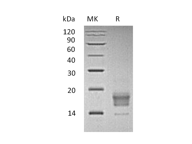 重组人TIGIT (C-6His)蛋白,Recombinant Human TIGIT (C-6His)