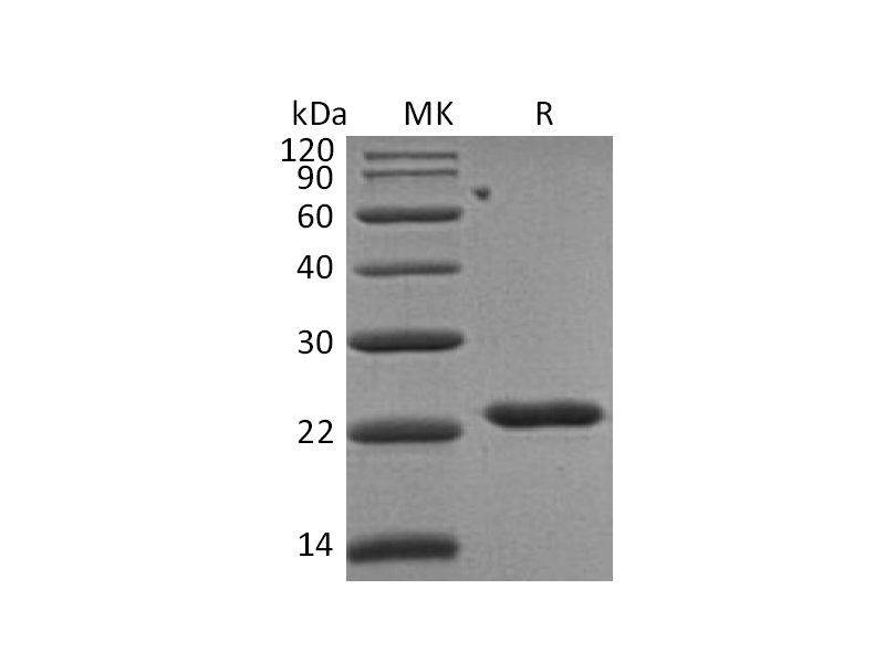 重组人TIMP-2 (C-6His)蛋白,Recombinant Human TIMP-2 (C-6His)
