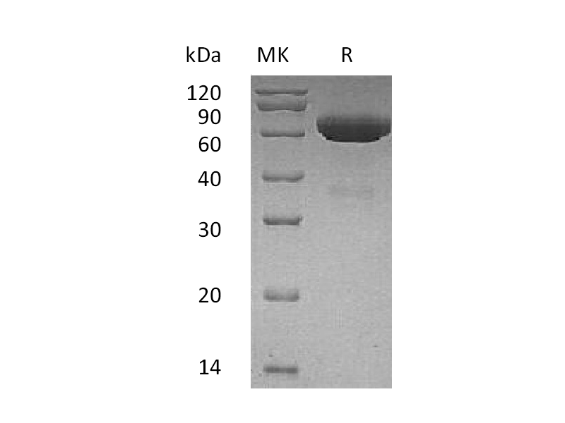 重组人tPA (C-6His)蛋白,Recombinant Human tPA (C-6His)