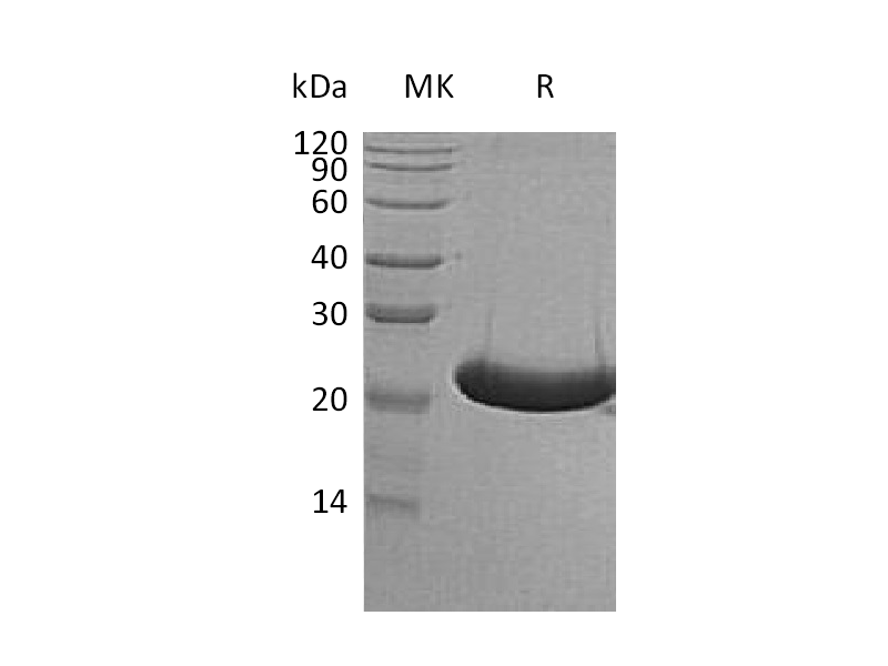 重组人TREML1 (C-6His)蛋白,Recombinant Human TREML1 (C-6His)