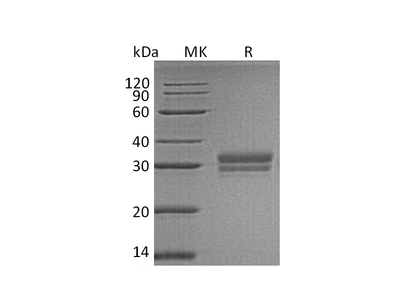 重组人VSIG2 (C-6His)蛋白,Recombinant Human VSIG2 (C-6His)