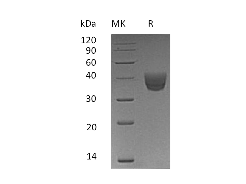 重组人CD157 (C-6His)蛋白,Recombinant Human CD157 (C-6His)
