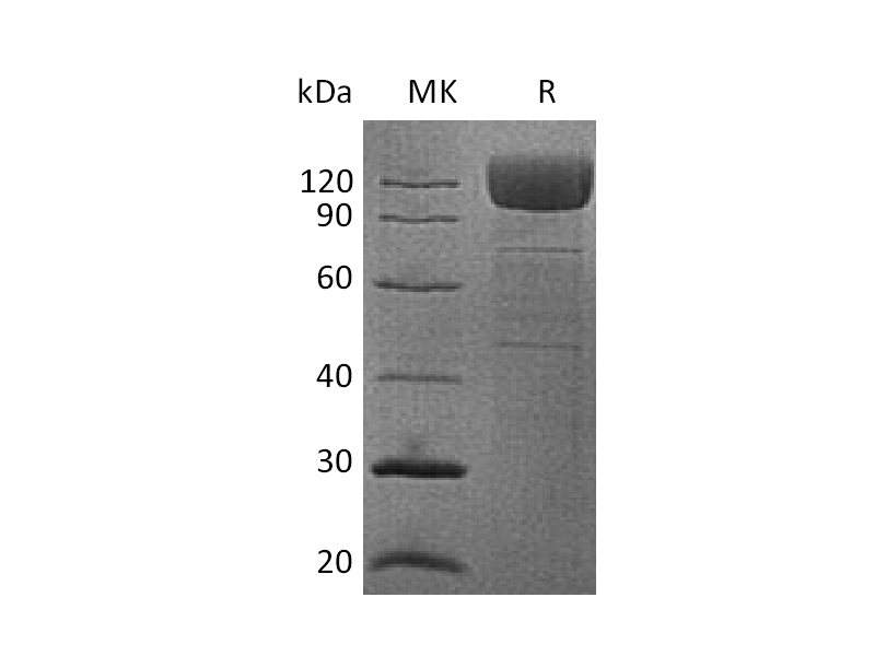 重组人CD36 (C-Fc)蛋白,Recombinant Human CD36 (C-Fc)