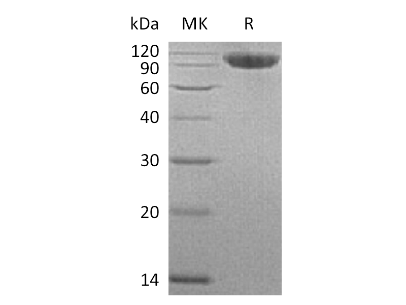 重组人CFHR4 (C-6His)蛋白,Recombinant Human CFHR4 (C-6His)