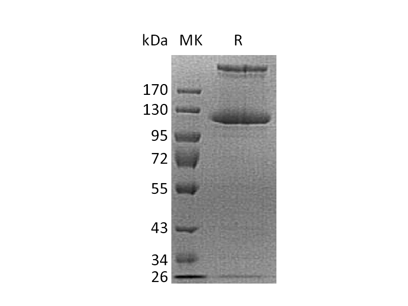 重组人COL21A1 (C-6His)蛋白,Recombinant Human COL21A1 (C-6His)