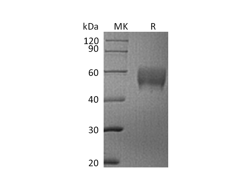 重组人Siglec-7 (C-6His)蛋白,Recombinant Human Siglec-7 (C-6His)