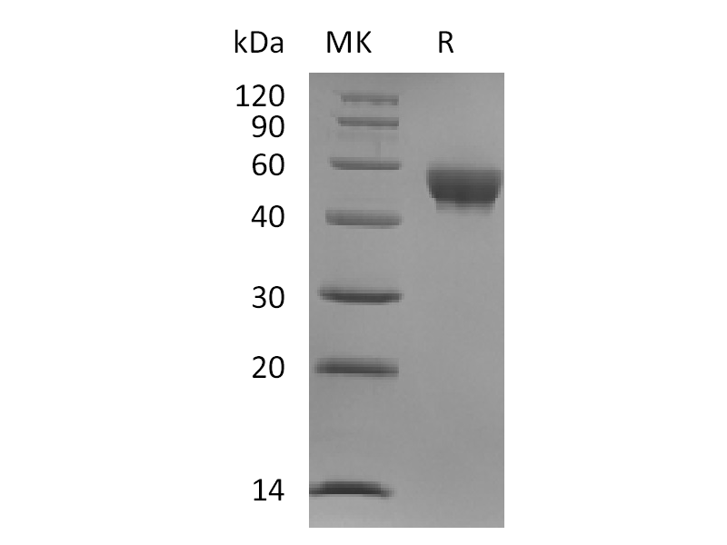 重组人Siglec-8 (C-6His)蛋白,Recombinant Human Siglec-8 (C-6His)