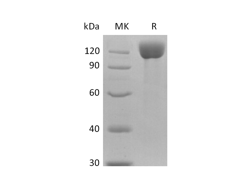 重组人APN Protein (C-6His)蛋白,Recombinant Human APN Protein (C-6His)