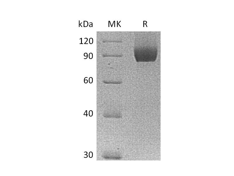 重组人Neuropilin-1 (C-6His)蛋白,Recombinant Human Neuropilin-1 (C-6His)