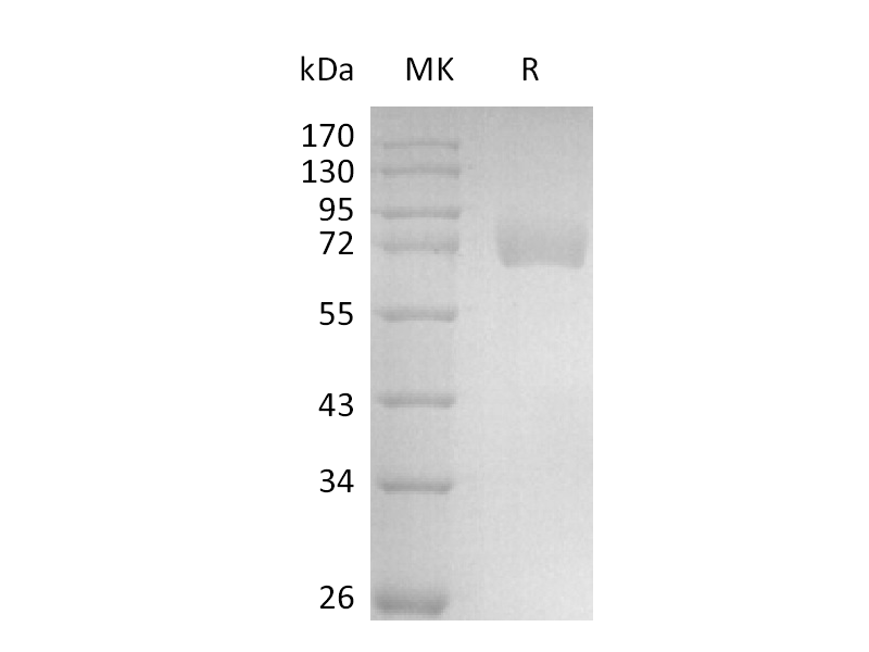 重组人Siglec-6 (C-Fc)蛋白,Recombinant Human Siglec-6 (C-Fc)
