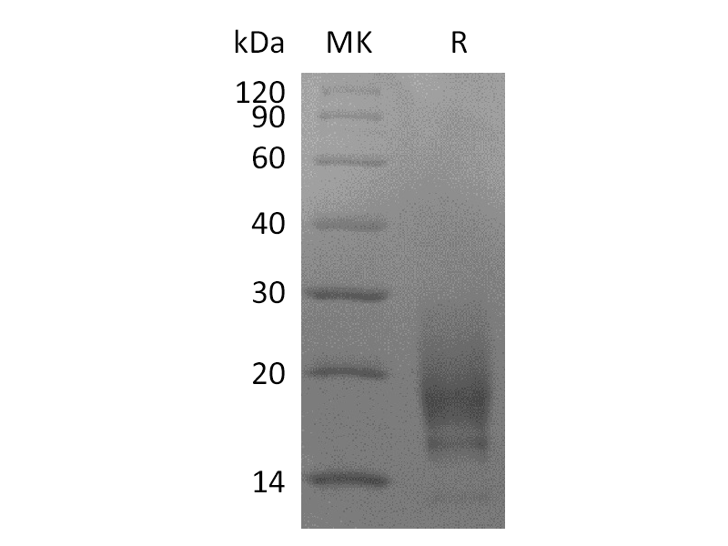 重组人CD63 (N-6His)蛋白,Recombinant Human CD63 (N-6His)