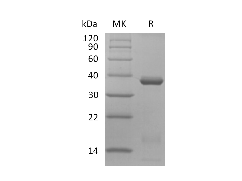 重组人IL-15RA&IL-15 Complex (C-Fc)蛋白,Recombinant Human IL-15RA&IL-15 Complex (C-Fc)