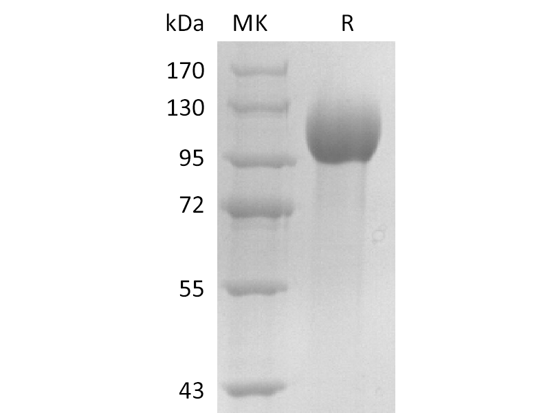 重组人ELAPOR1 (C-6His)蛋白,Recombinant Human ELAPOR1 (C-6His)