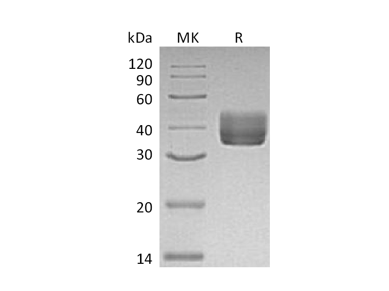 重组小鼠CD157 (C-6His)蛋白,Recombinant Mouse CD157 (C-6His)