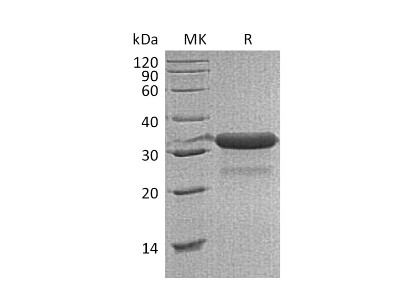 重组小鼠IGFBP-7 (C-6His)蛋白,Recombinant Mouse IGFBP-7 (C-6His)