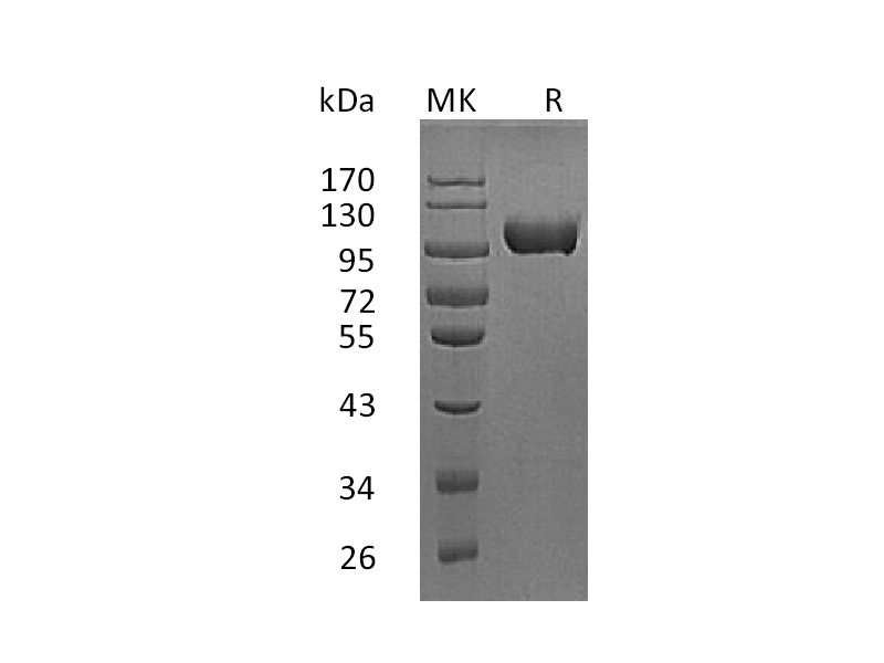 重组小鼠MMP-9 (C-10His)蛋白,Recombinant Mouse MMP-9 (C-10His)