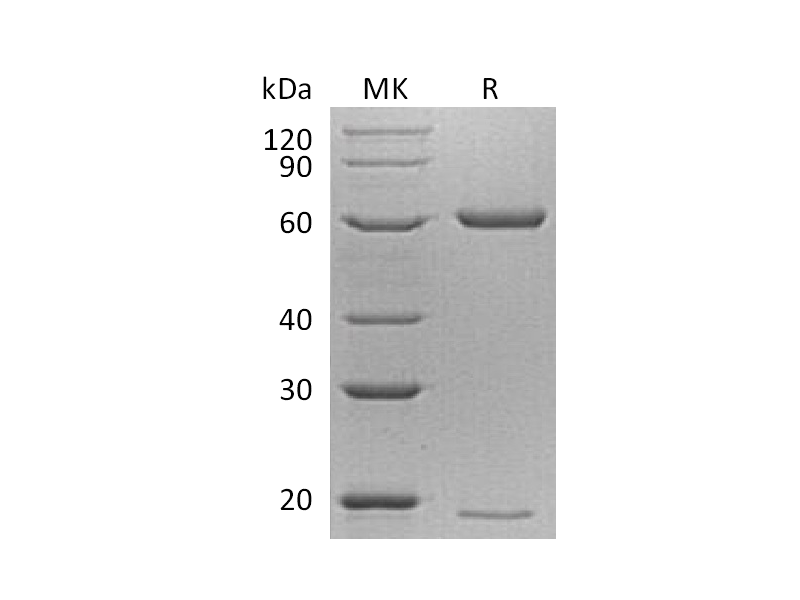 重组小鼠PCSK9 (C-6His)蛋白,Recombinant Mouse PCSK9 (C-6His)