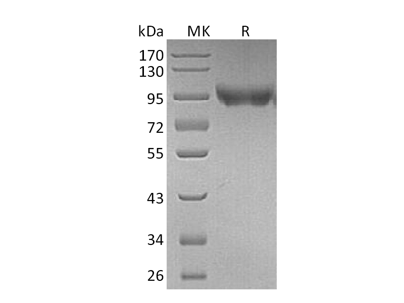 重组小鼠CD31 (C-6His)蛋白,Recombinant Mouse CD31 (C-6His)