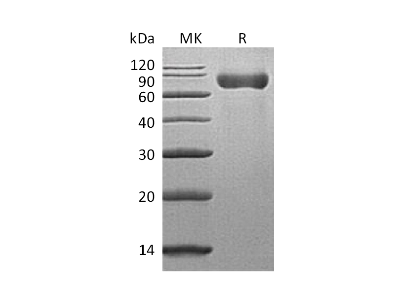 重组小鼠SLAMF3 (C-6His)蛋白,Recombinant Mouse SLAMF3 (C-6His)