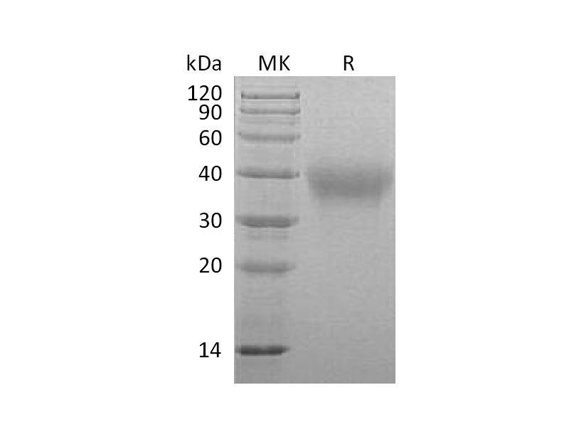 重组绒猴TIM-3 (C-6His)蛋白,Recombinant Marmoset TIM-3 (C-6His)