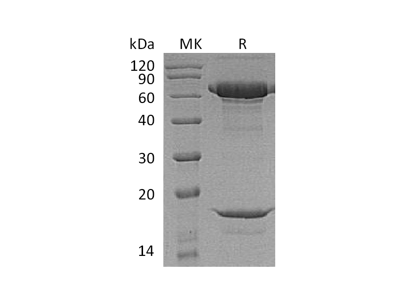 重组豚尾猴PCSK9 (C-6His)蛋白,Recombinant Macaca nemestrina PCSK9 (C-6His)