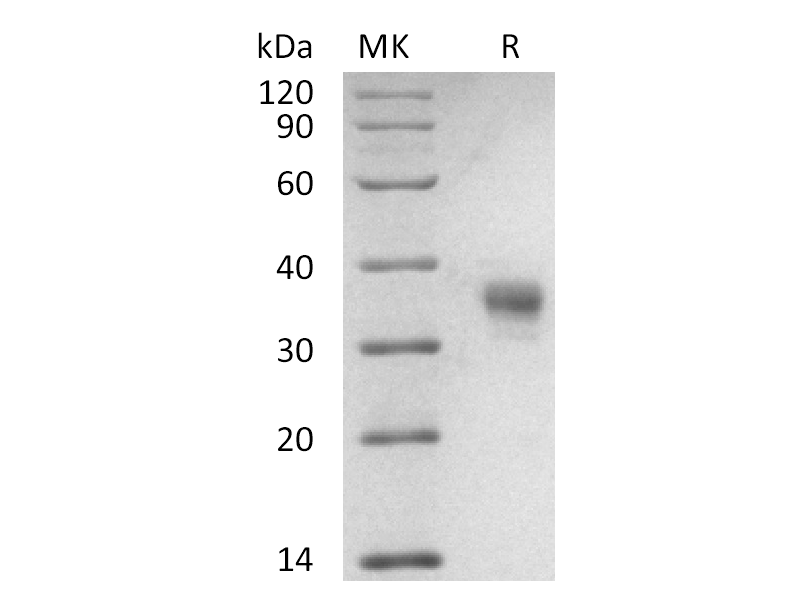 重组食蟹猴LILRB4 (C-6His)蛋白,Recombinant Cynomolgus LILRB4 (C-6His)