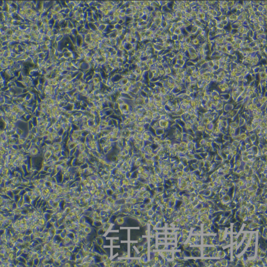 MyC-CaP（小鼠前列腺癌细胞）YB-7056MC,MyC-CaP