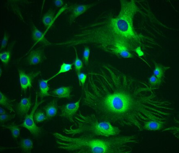 小鼠肾间质成纤维细胞,Mouse renal interstitial fibroblasts