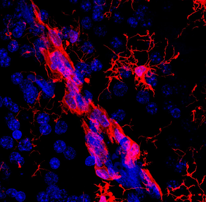 小鼠肾小球系膜细胞,Mouse mesangial cells