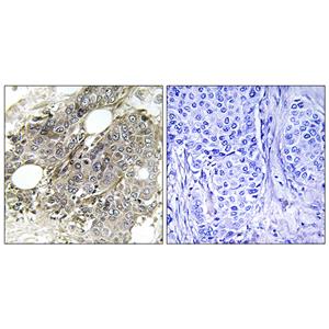 TGFβ RIII兔多抗,TGFβ RIII Rabbit Polyclonal Antibody